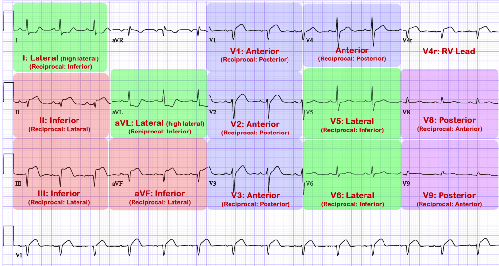 ECG Lead Placement - Cardio Guide