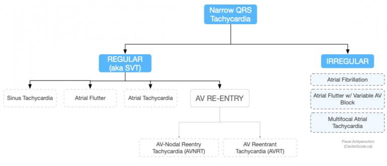 Narrow QRS Tachycardia – Cardio Guide