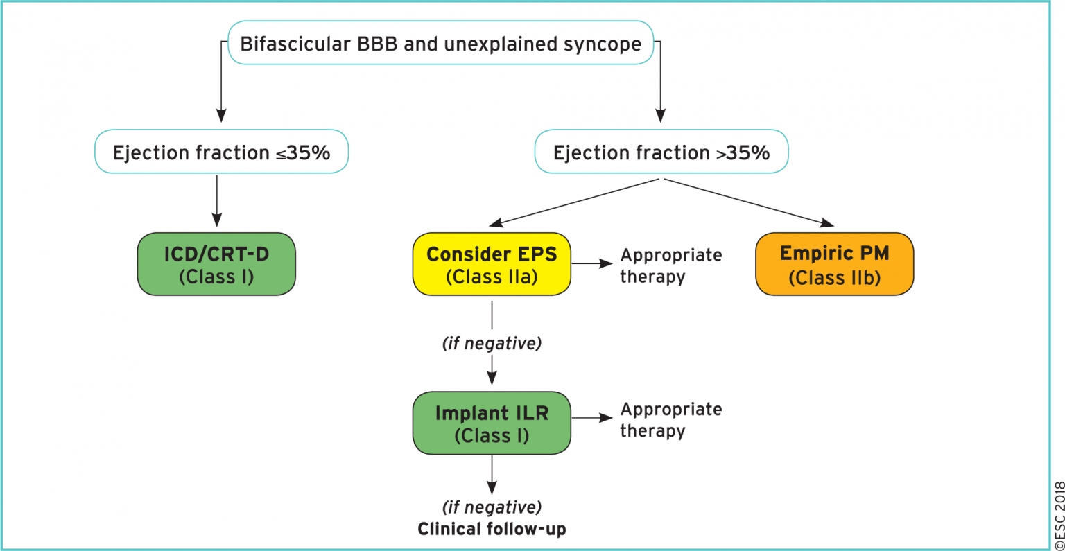 Cardiac Syncope Management - Cardio Guide