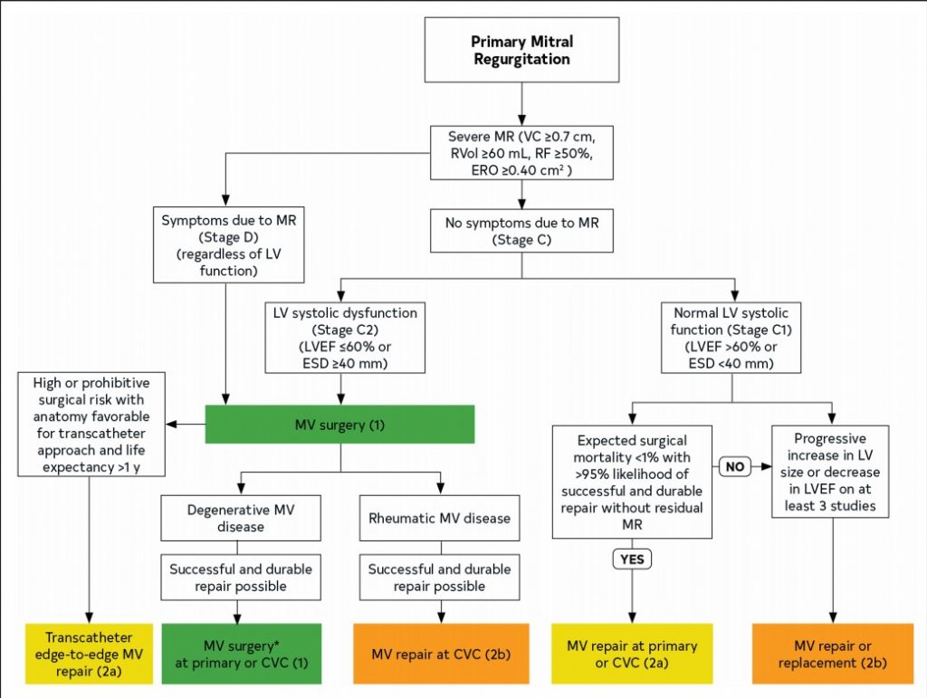 Mitral Regurgitation - Cardio Guide